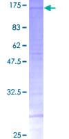 Human SRPK2 Protein (Recombinant GST)