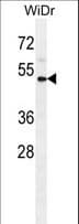 CD121b / IL1R2 Antibody (aa273-300)