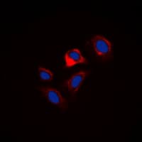 PLN / Phospholamban Antibody (N-Terminus)
