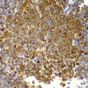 TLR2 Antibody