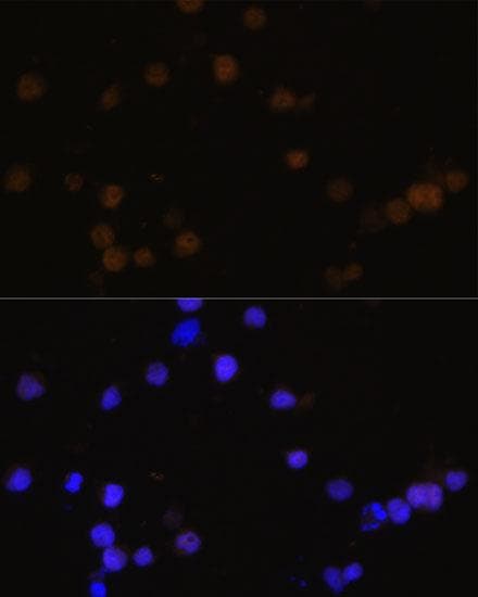 RB1 / Retinoblastoma / RB Antibody