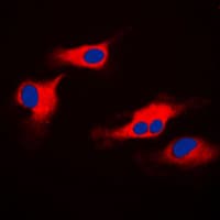 IHC-plus™ Polyclonal Rabbit anti-Human ORAOV1 Antibody (Internal, IHC, IF, WB)