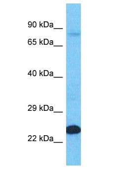 LNX2 Antibody (aa315-364)