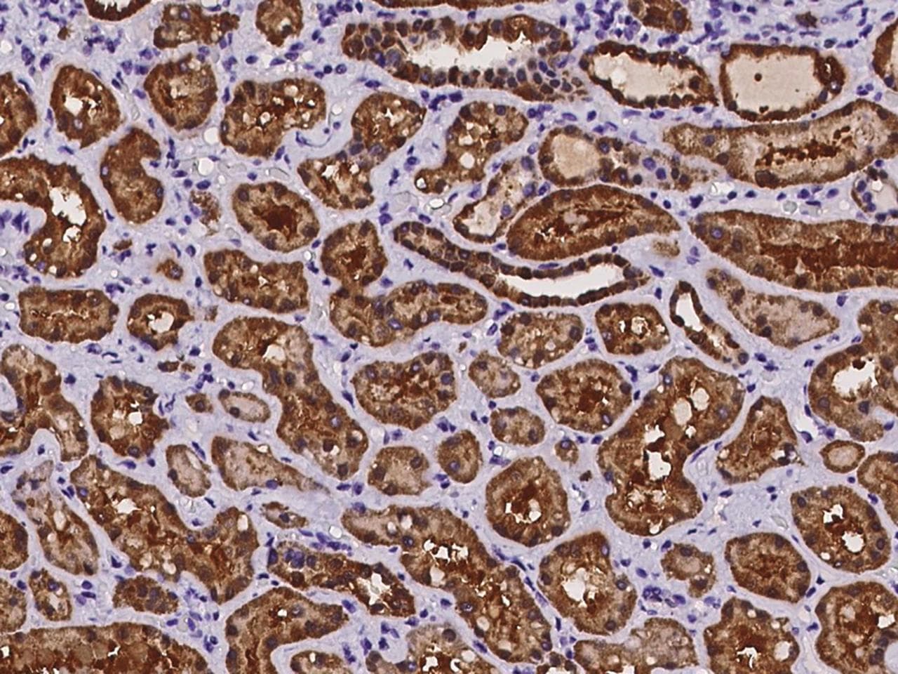 Polyclonal Rabbit anti-Human CRYZ Antibody (IHC)