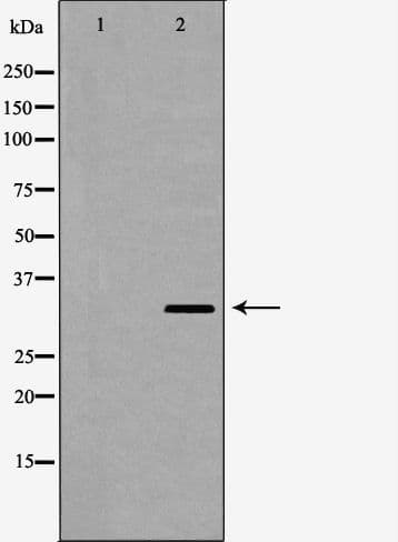 SULT2A1 / Sulfotransferase 2A1 Antibody