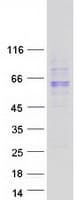 Human UGT1A10 Protein (Recombinant Myc-DDK (Flag))
