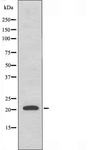 SCLIP / STMN3 Antibody