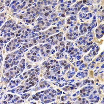 Polyclonal Rabbit anti-Human HIRIP3 Antibody (IHC, IF, WB)