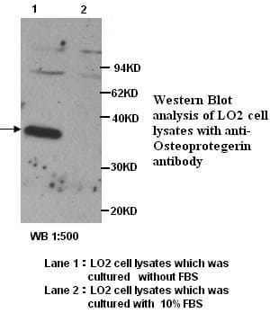 IHC-plus™ Polyclonal Rabbit anti-Human OPG / Osteoprotegerin Antibody (IHC, WB)