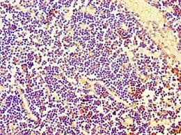 PBK / TOPK Antibody (aa1-322)