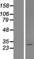 COPZ2 Protein (Over-Expression Lysate Myc-DDK (Flag))