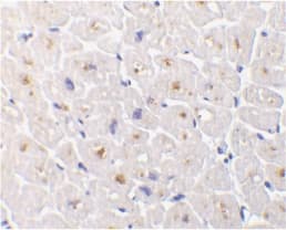 TNFRSF6B / DCR3 Antibody