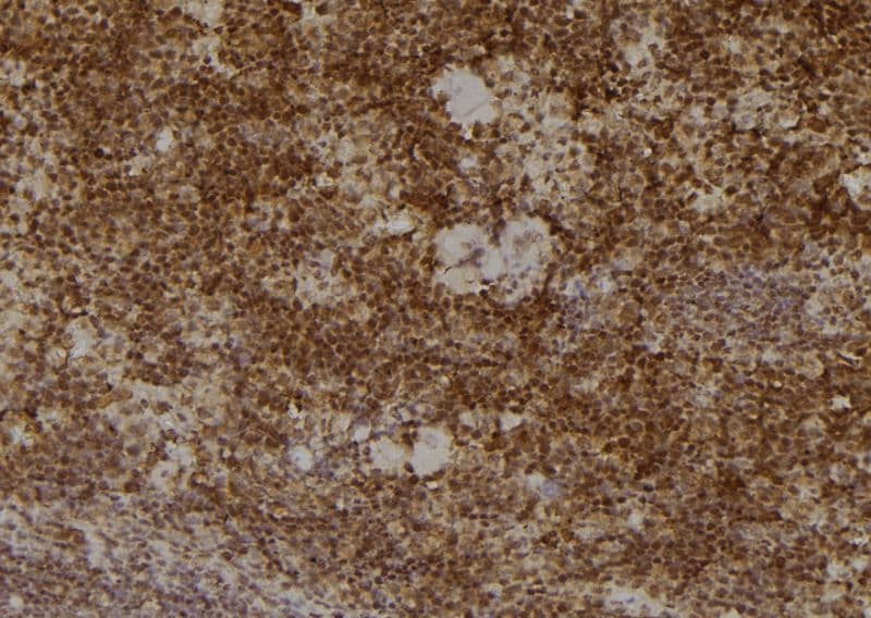 Polyclonal Rabbit anti-Human PSMA2 Antibody (IHC, WB)