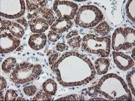 RPN1 / Ribophorin I Antibody (clone OTI3E1, Carrier-free)