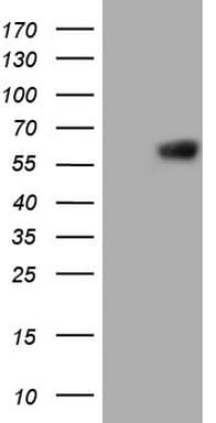 PROZ / Protein Z Antibody (aa115-400, clone OTI4F1)