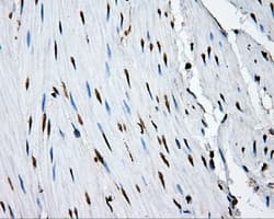 HMRF1L / MTRF1L Antibody (clone OTI1E3)
