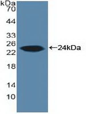 CYP19 / Aromatase Antibody (aa196-373)