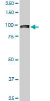 IHC-plus™ Monoclonal Mouse anti-Human UBTF / UBF Antibody (clone 2D8, IHC, IF, WB)