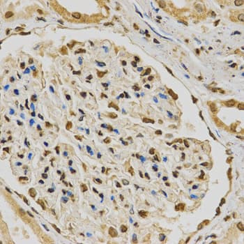 HNRNPA2B1 Antibody