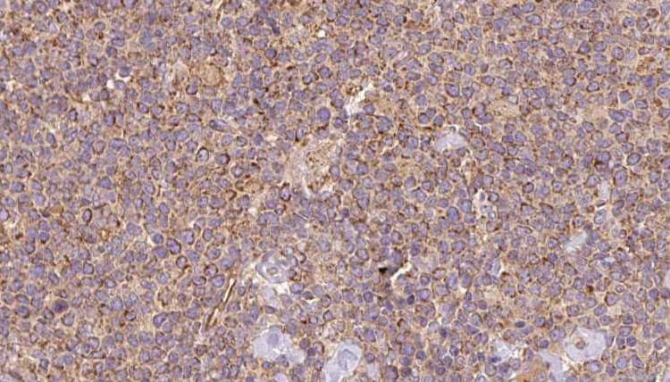 ASRGL1 Antibody