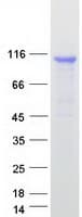 Human DDX58 / RIG-1 / RIG-I Protein (Recombinant Myc-DDK (Flag))