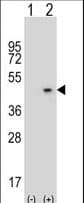 AZGP1 / ZAG Antibody (aa5-32)