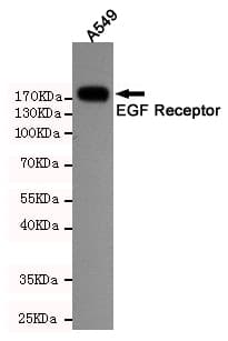 Monoclonal Mouse anti-Human EGFR Antibody (WB)