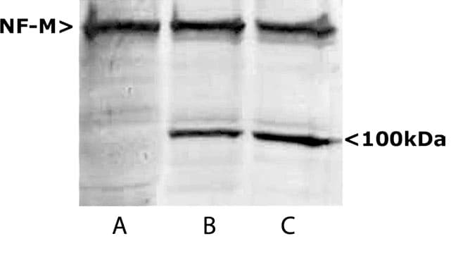 NEFM / NF-M Antibody