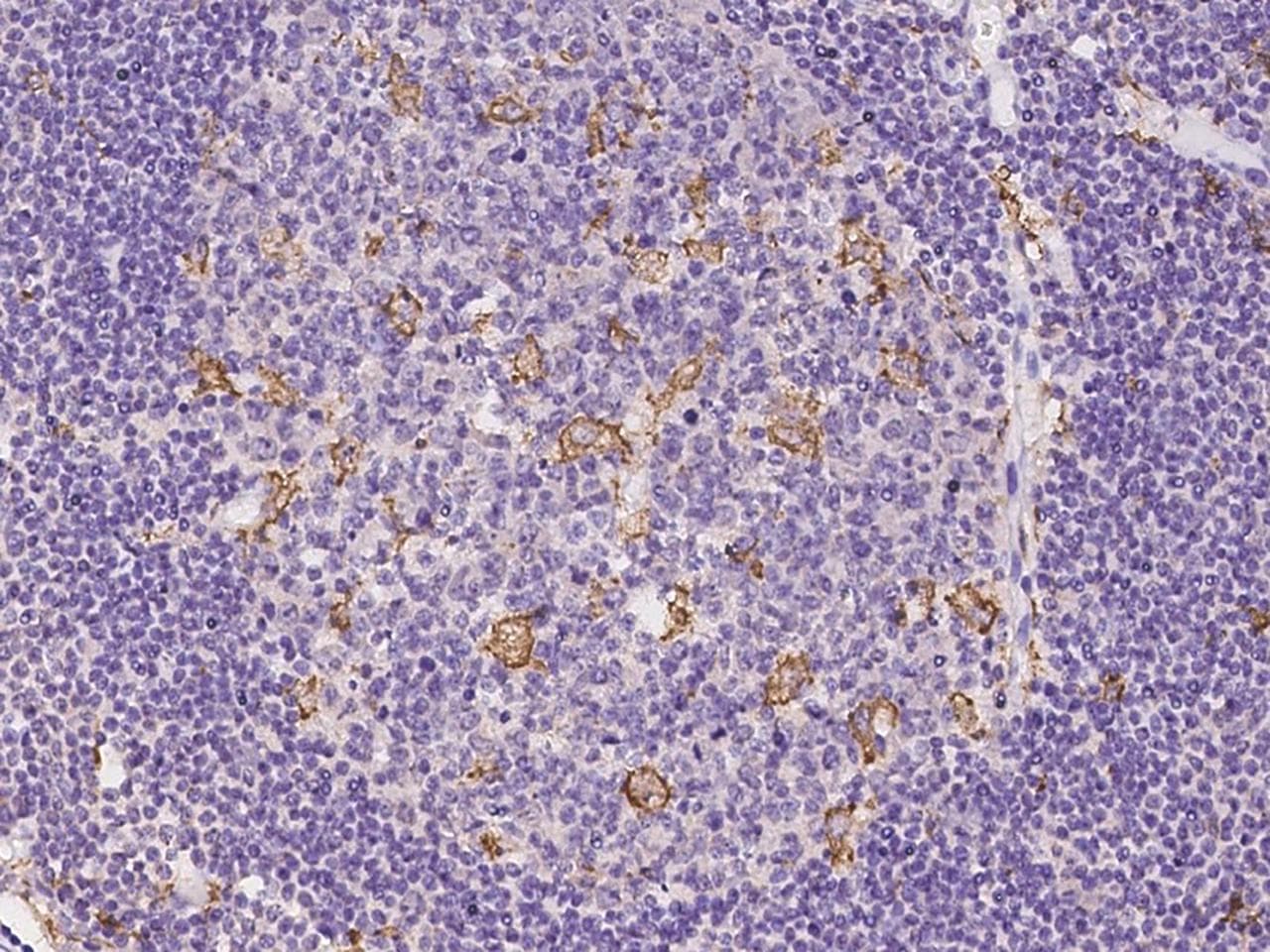 Polyclonal Rabbit anti-Human SKAP2 / SCAP2 Antibody (IHC)