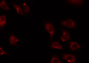 Polyclonal Rabbit anti-Human MRPL16 Antibody (IHC, IF, WB)