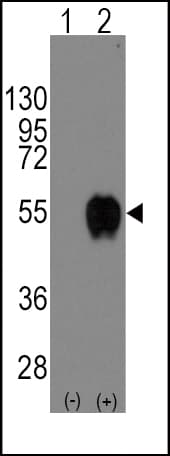 CD14 Antibody (aa54-83)