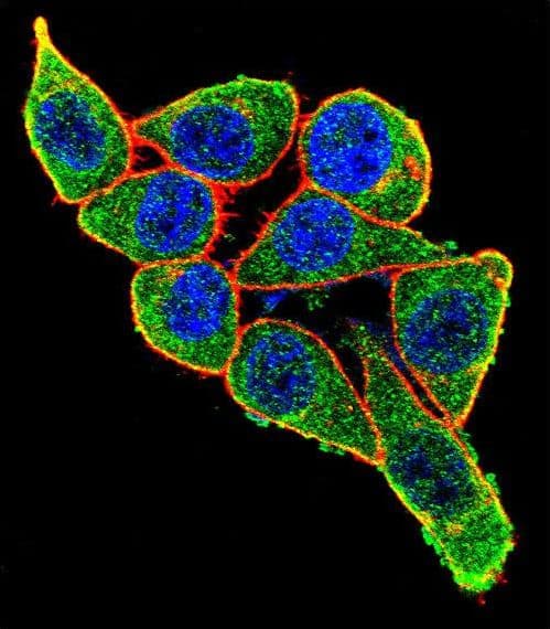 Polyclonal Rabbit anti-Human PAX6 Antibody (IHC, IF, WB)