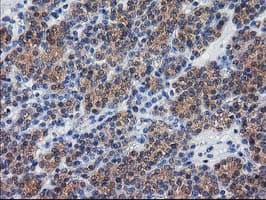 DSTN / Destrin Antibody (clone OTI1C8)