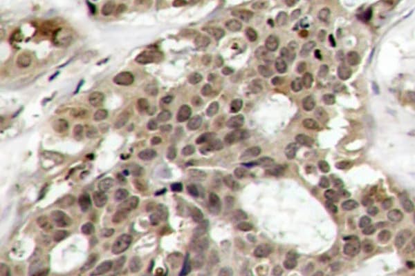 Polyclonal Rabbit anti-Human ERK1 + ERK2 Antibody (phospho-Tyr204, IHC, IF, WB)