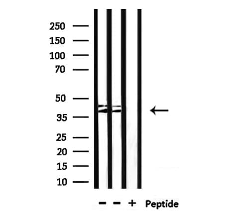 CYP4Z1 Antibody