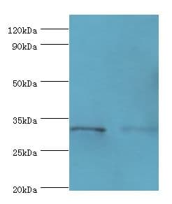 EDA2R / XEDAR Antibody (aa1-138)