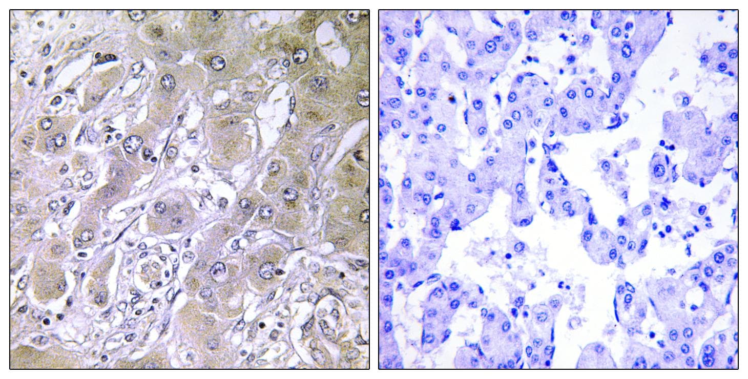 ACOT12 Antibody