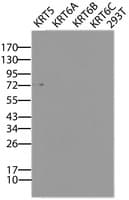 KRT5 / CK5 / Cytokeratin 5 Antibody (clone OTI1E6)