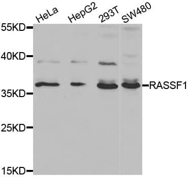 PathPlus™ Polyclonal Rabbit anti-Human RASSF1 / RASSF1A Antibody (IHC, IF, WB)