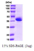Human GOK / STIM1 Protein (Recombinant)