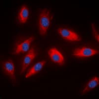 ACLY / ATP Citrate Lyase Antibody (Internal)