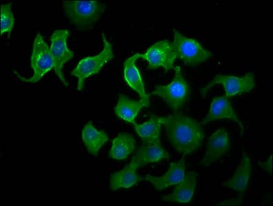Polyclonal Rabbit anti-Human TTI2 / C8orf41 Antibody (IHC, IF, WB)