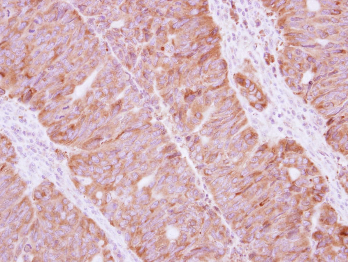 Polyclonal Rabbit anti-Human STAU1 / Staufen Antibody (IHC, WB)