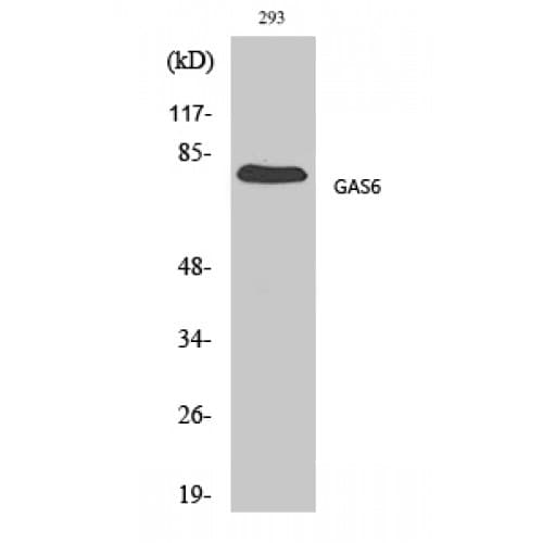 Polyclonal Rabbit anti-Human GAS6 Antibody (260-340 aa, Internal, IHC, WB)
