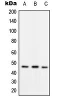 Polyclonal Rabbit anti-Human RAD52 Antibody (phospho-Tyr104, WB)