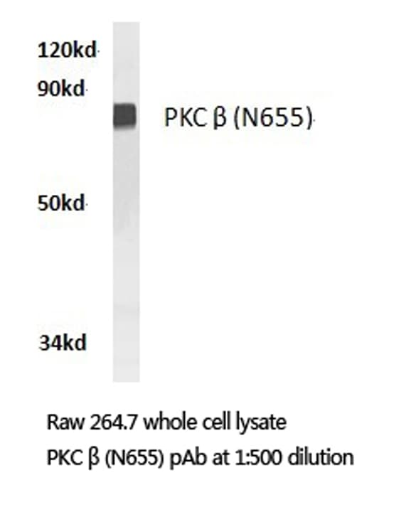 IHC-plus™ PRKCB / PKC-Beta Antibody (aa621-670)