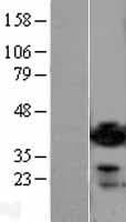 ADPRH / ARH1 Protein (Over-Expression Lysate Myc-DDK (Flag))