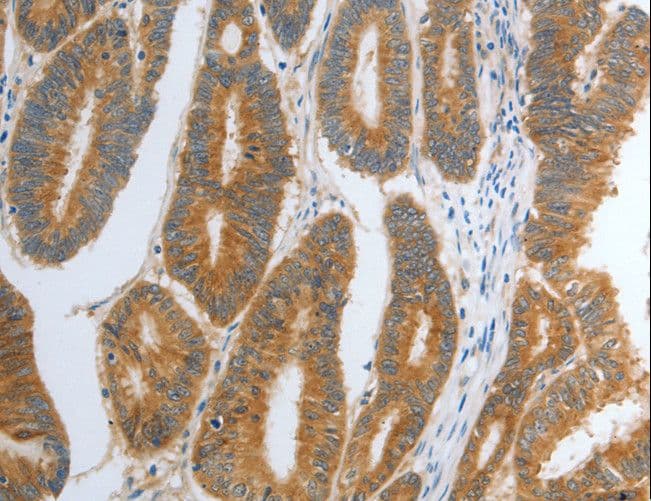 RHEB Antibody