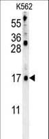 LCE2B Antibody (aa61-90)