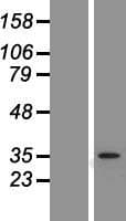 RNF41 Protein (Over-Expression Lysate Myc-DDK (Flag))